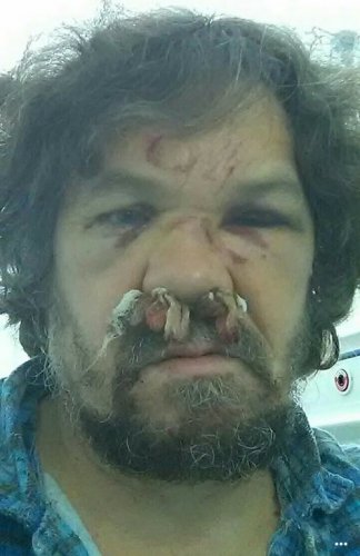 Андрей Рудомаха после госпитализации