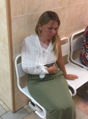 Жительница хутора Ленина Анжелика Мастяева в больнице после травмы, нанесенной ей лесорубом
