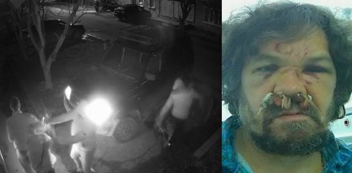 Координатор ЭВСК Андрей Рудомаха в больнице